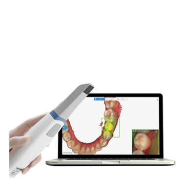 Scanner Intra-oral Menu