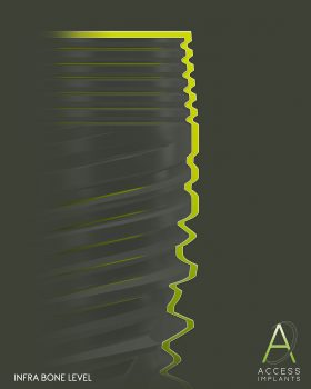 Access Dental Implants System - Download