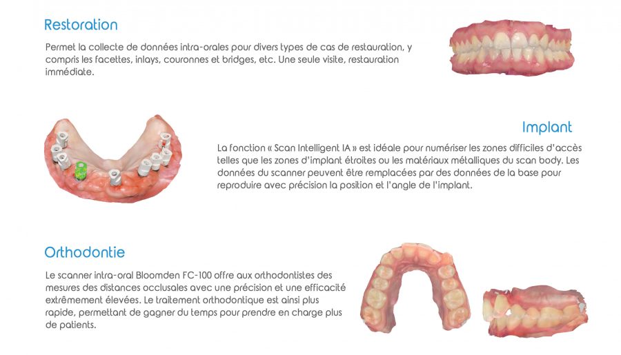 Bloomden_SCANNER_IntraO_3